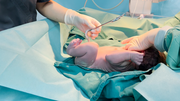 醫生為胎兒輸臍血。重慶安琪兒婦產醫院供圖