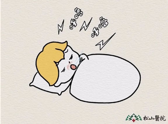睡覺打鼾。重慶松山醫院供圖