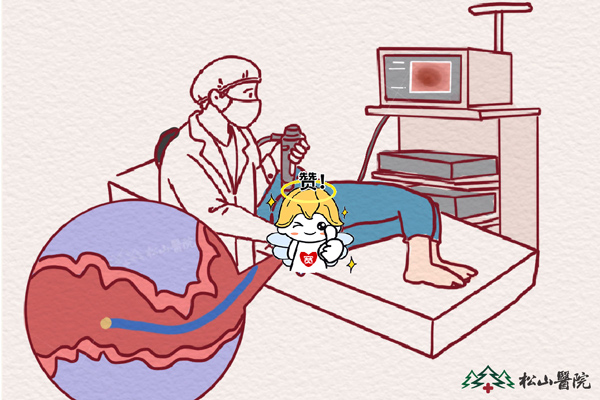 腸鏡檢查。重慶松山醫院供圖