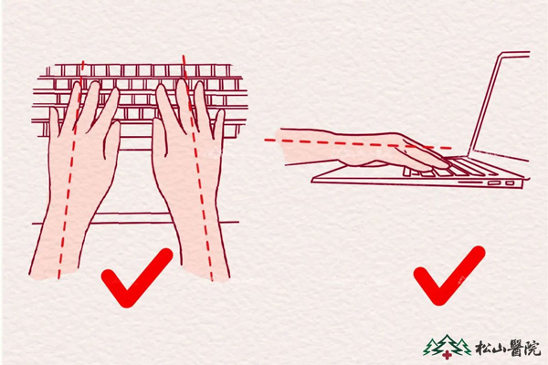 敲擊鍵盤的正確姿勢。重慶松山醫院供圖
