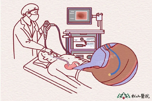 胃鏡檢查。重慶松山醫院供圖