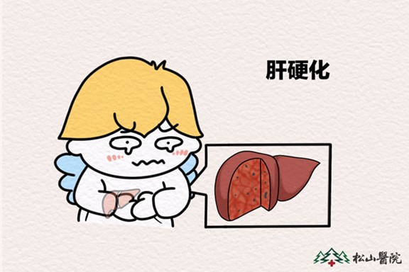 肝硬化。重慶松山醫院供圖