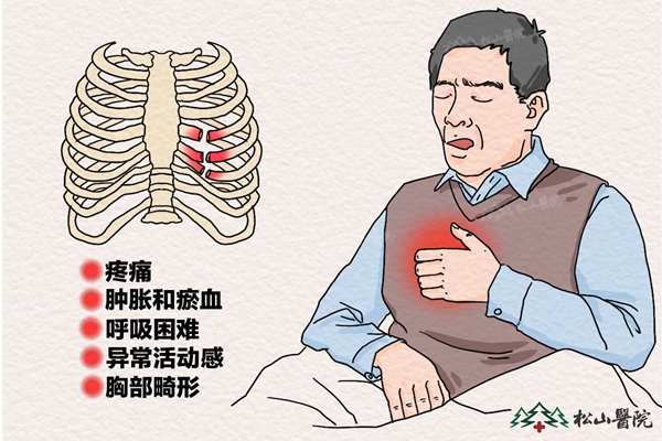 肋骨骨折癥狀。重慶松山醫院供圖