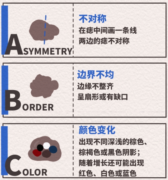 五步法（一）。重慶松山醫院供圖