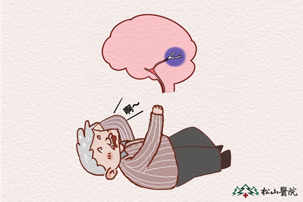 腦卒中。重慶松山醫院供圖