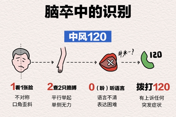 “中風120”口訣。重慶松山醫院供圖