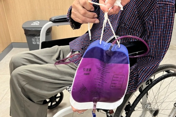 秦大爺出現“紫色尿液”。重慶西區醫院供圖