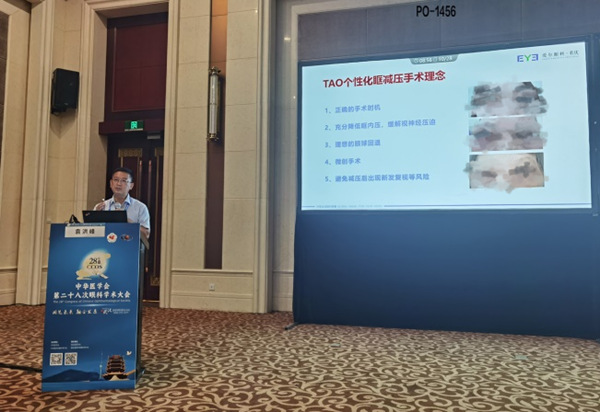 袁洪峰上臺分享。重慶愛爾眼科醫院總院供圖