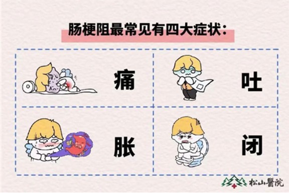 腸梗阻癥狀。重慶松山醫院供圖