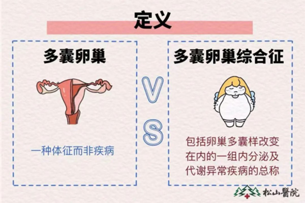 多囊與多囊卵巢綜合征的定義。重慶松山醫院供圖