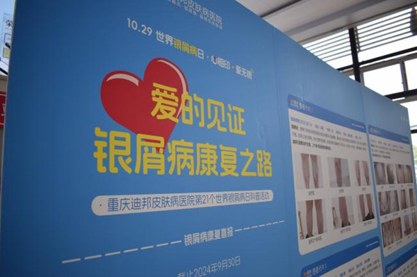活動現場。重慶迪邦皮膚病醫院供圖