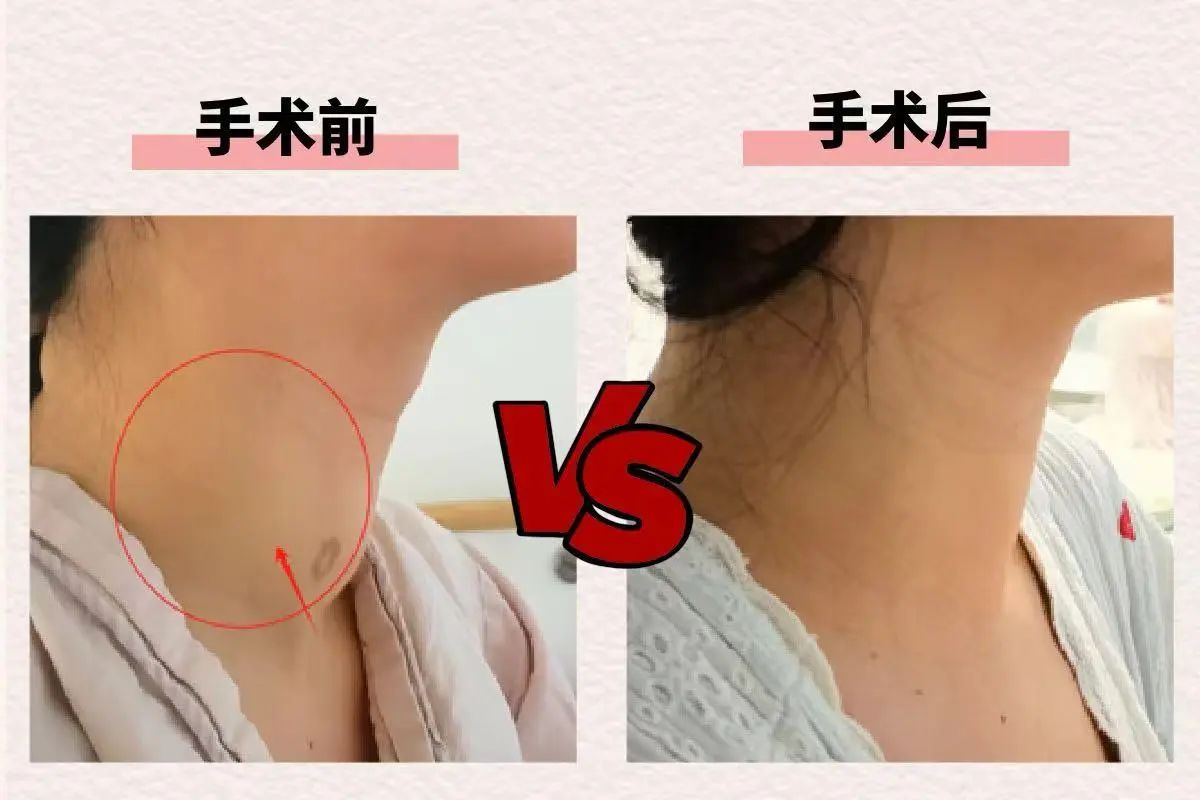 術后情況。重慶松山醫院供圖