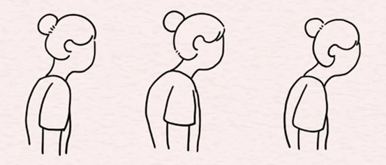 示意圖。重慶松山醫院供圖