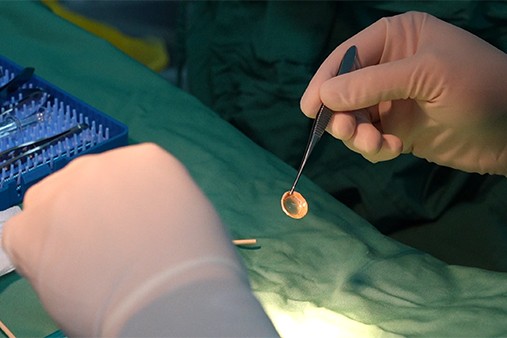 手術現場。重慶普瑞眼科醫院供圖