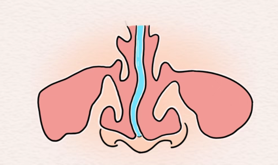 示意圖。重慶松山醫院供圖